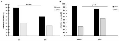 EBV and multiple sclerosis: expression of LMP2A in MS patients